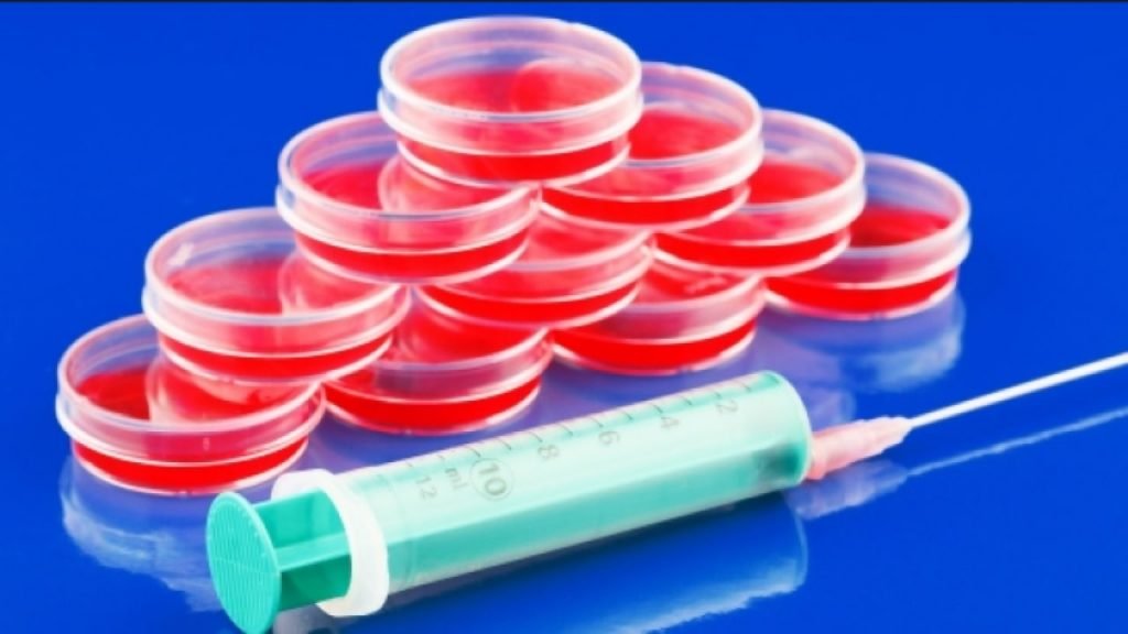 Aplastik Anemi Nedir?